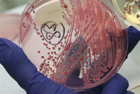 Number of People in Latest E. Coli Outbreak Expected to Grow