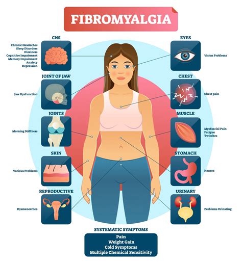 What is Fibromyalgia? - Theramotion