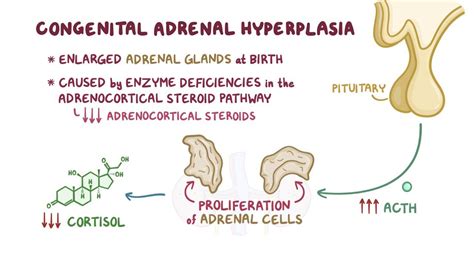 Congenital Adrenal Hyperplasia