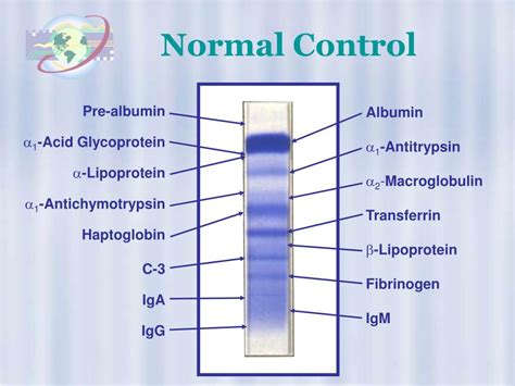 PPT - High Resolution Protein Electrophoresis PowerPoint Presentation ...