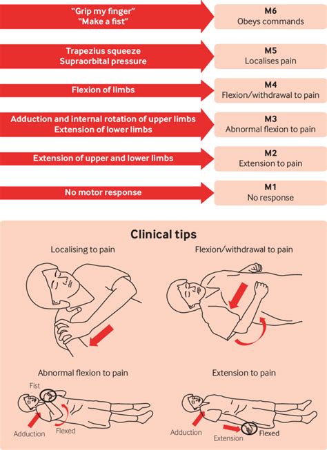 Images of Glasgow Coma Scale - JapaneseClass.jp