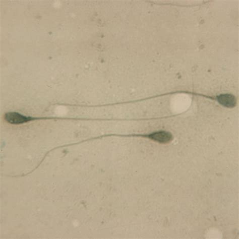 Human Sperm Slide, Smear | Carolina Biological Supply