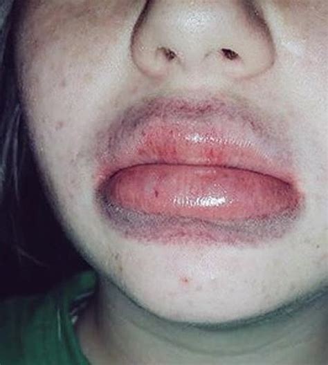 Kylie Jenner Lip Challenge: Fail!!