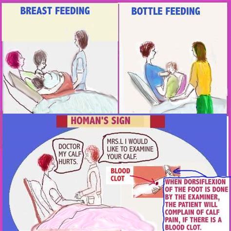 Dear Nurses: HOMAN'S SIGN - WHAT IS IT?