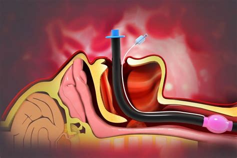 What Are The Causes Of Swollen Uvula? 11 Common Triggers - OptingHealth