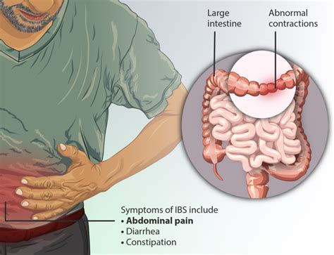 Can IBS Cause Ribbon Stools? » Scary Symptoms