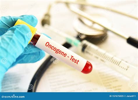 Blood Sample for Oncogene Test Stock Image - Image of chromosome, ca15 ...