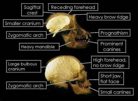 Australopithecus Robustus Skull Features