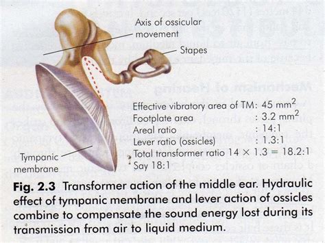 Ossiculoplasty