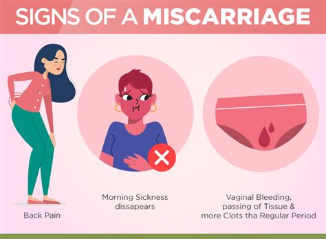 Recurrent Pregnancy Loss | Miscarriage Treatment Gurgaon