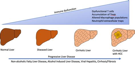 Frontiers | The effect of liver disease on hepatic microenvironment and implications for immune ...