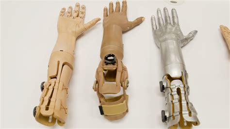 3d Printed Prosthetic Arm