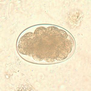 CDC - DPDx - Intestinal Hookworm