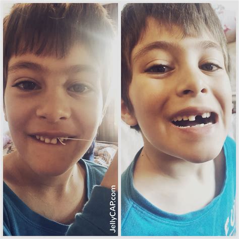M: Can I pull my teeth out?😱💪 D: Sure, here is some floss 😁 #Growingupfast #Kids #Firstteeth # ...