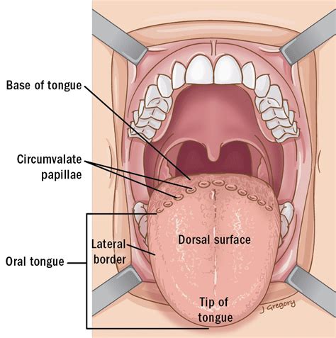 Tongue Cancer ‣ Anatomy ‣ THANC Guide