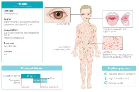 Chicken Pox Roseola Vs Measles Rash - pic-fisticuffs