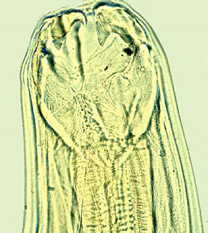 Ancylostoma braziliense - Alchetron, the free social encyclopedia