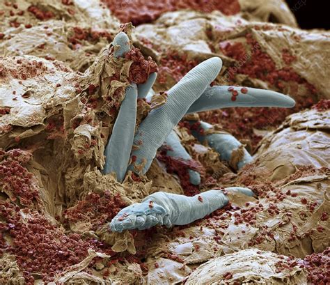 Dog mange mites, SEM - Stock Image - C002/5651 - Science Photo Library