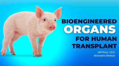 Pig Organs Bioengineered for Human Transplant - YouTube