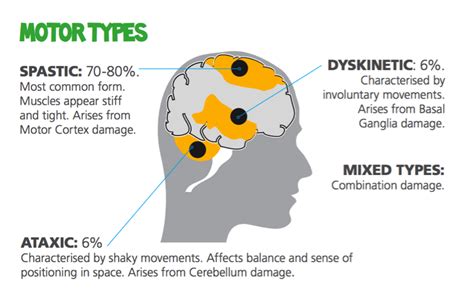 Four Types Of Cerebral Palsy