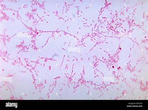 This photomicrograph shows Fusobacterium necrophorum bacteria cultured in a thioglycollate ...