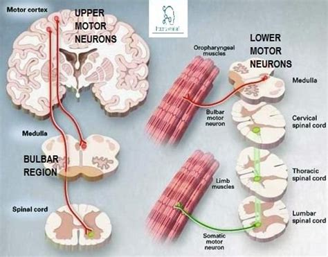 Upper Motor vs. Lower Motor Neuron Disease » How To Relief | Motor neuron, Neurons, Motor neuron ...