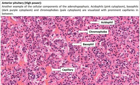 Brain – Pituitary – NUS Pathweb :: NUS Pathweb