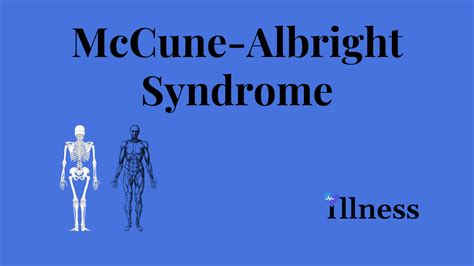 McCune-Albright Syndrome : Overview, Causes, Symptoms, Treatment - illness.com