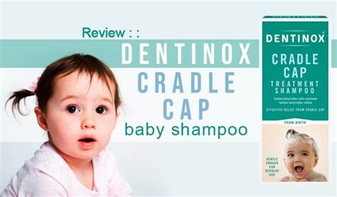 Review :: Dentinox Cradle Cap Baby Shampoo - Dandruff Deconstructed