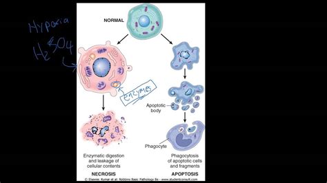 #4 - Introduction to Pathology - Necrosis vs. Apoptosis - YouTube