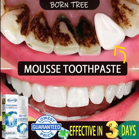 hunmui toothpaste original niacinamide toothpaste whitening for teeth ...