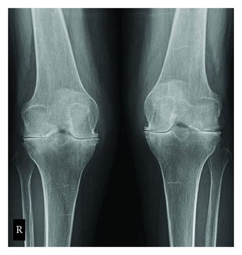 Radiographic Positioning Examples of the Leg and Knee - CE4RT