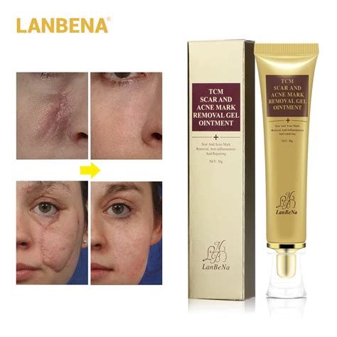 LANBENA Acne Scar Removal Cream Skin Repair Face Cream Acne Treatment ...