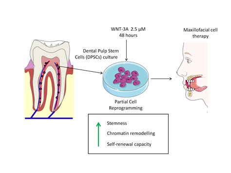 Cells | Free Full-Text | Wnt-3a Induces Epigenetic Remodeling in Human Dental Pulp Stem Cells