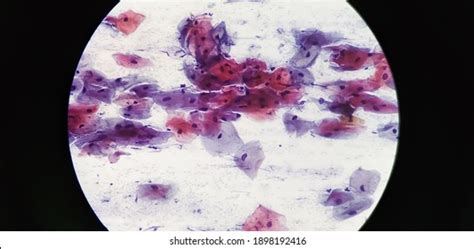 116 Endocervical cells Images, Stock Photos & Vectors | Shutterstock