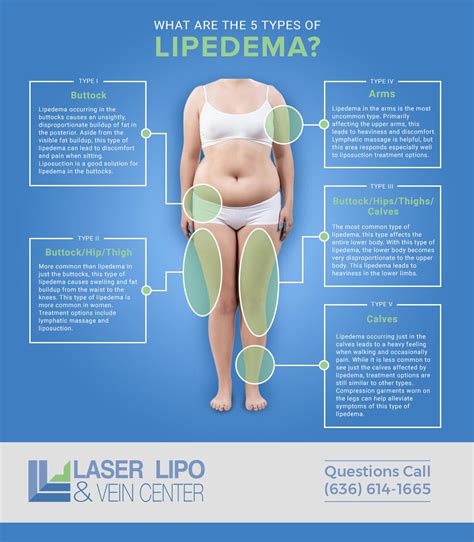 St Louis Lipedema Liposuction Treatment | Laser Lipo and Vein Center