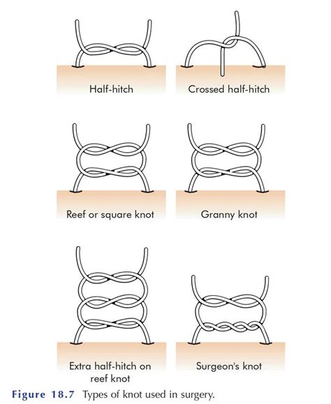 types of knots used in surgery - MEDizzy