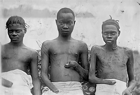 The Belgian Congo's Hacked Hands: A Brutal Reminder of Colonial Atrocities