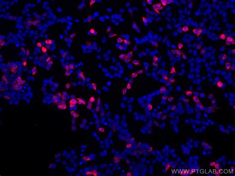 6*His, His-Tag antibody (CL594-66005) | Proteintech