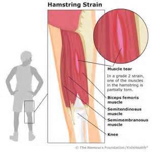 PULLED HAMSTRING IN CHILDREN 1 - Muscle Pull | Muscle Pull