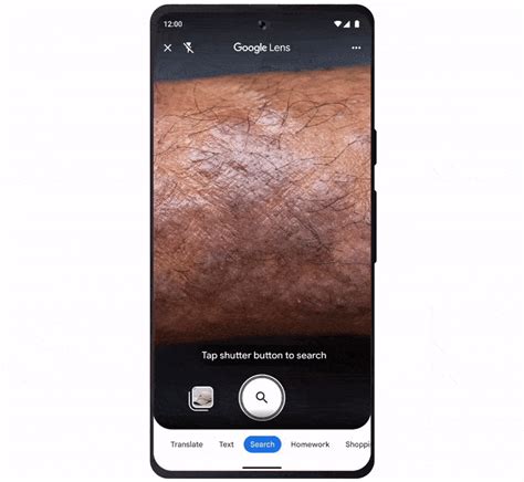 Google Lens Updated With Support for Skin Condition Detection; Google Bard Adds Lens Support ...