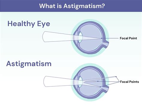 What Is Astigmatism? | Glasses.com®