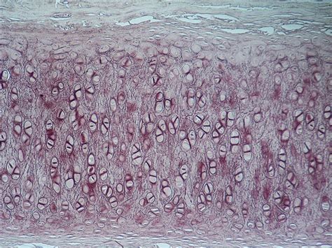 Difference Between Chondroblasts and Chondrocytes | Chondroblasts vs Chondrocytes