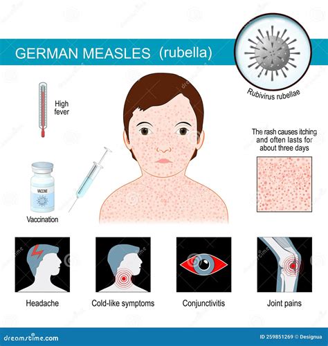 German Measles. Infographics about Symptoms of Rubella Stock Vector - Illustration of itching ...