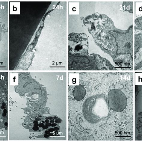 Morphological characteristics of human chondrocytes visualized by phase ...