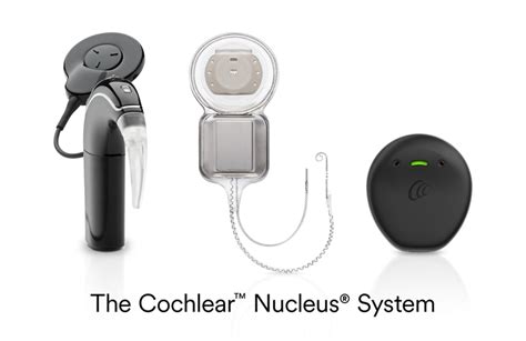 FDA approves Cochlear Nucleus Implant for unilateral hearing loss ...