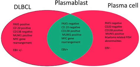 Plasmablastic Lymphoma: Past, Present, and Future - Clinical Lymphoma, Myeloma and Leukemia