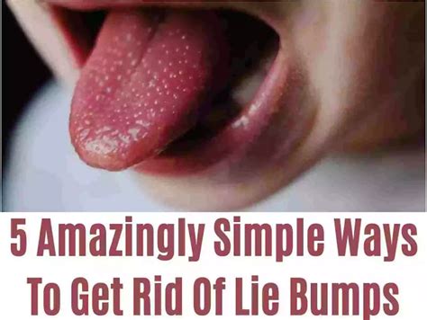 How To Get Rid Of Lie Bumps - 5 Easiest Ways To Get Rid Of Lie Bumps - Million-$-Knowledge