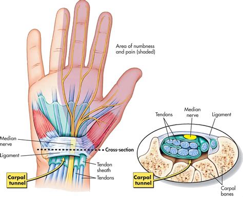 The Wrist And Carpal Tunnel - CoreWalking