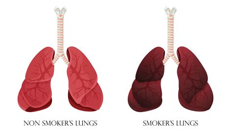 Illustration of normal healthy lungs and lungs smoker. Concept of stop ...